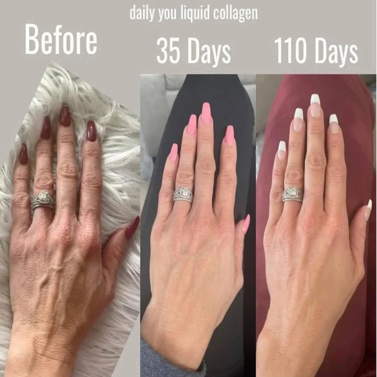 Gluta Collagen Pink Dietary Supplement এর উপকারিতাঃ