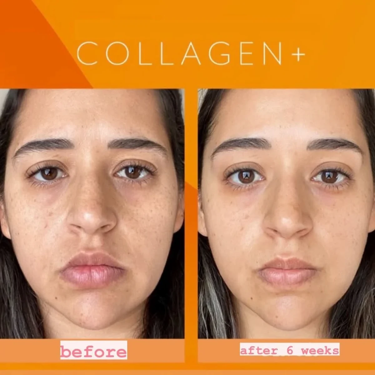Gluta Collagen Pink Dietary Supplement এর উপকারিতাঃ
